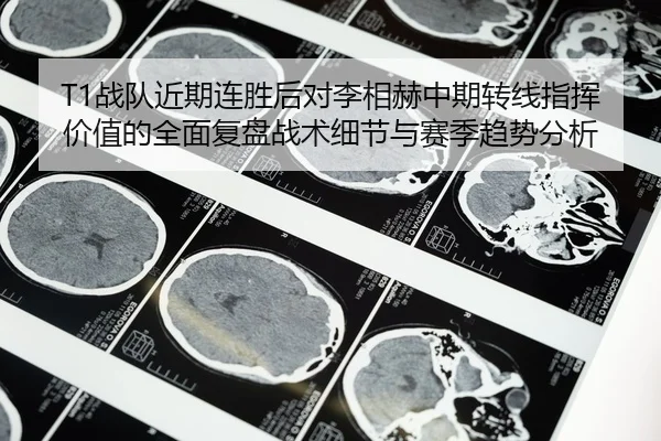 zhan-dui-jin-qi-lian-sheng-hou-dui-li-xiang-he-zhong-qi-zhuan-xian-zhi-hui-jia-zhi-de-quan-mian-fu-pan-zhan-shu-xi-jie-2-941.jpg